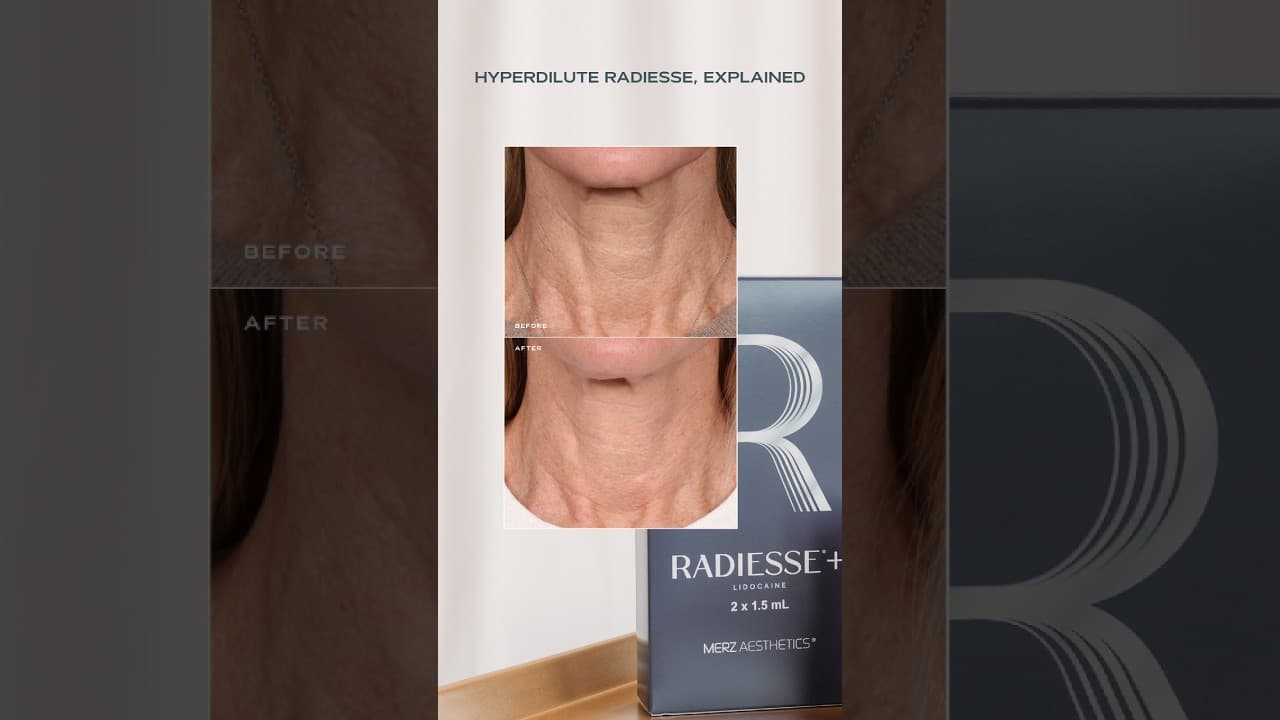 Video thumbnail: What Is Hyperdilute Radiesse? (Same Product, Different Job)