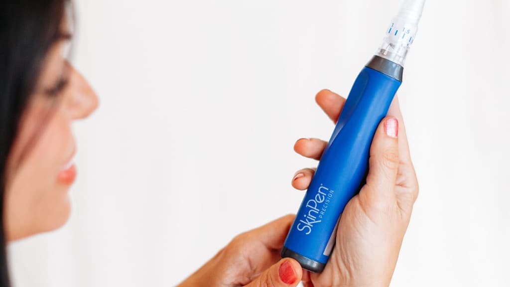 SkinPen treatment at The Look Aesthetics