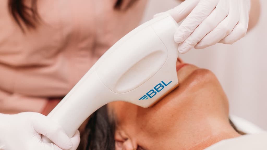SkinTyte treatment at The Look Aesthetics