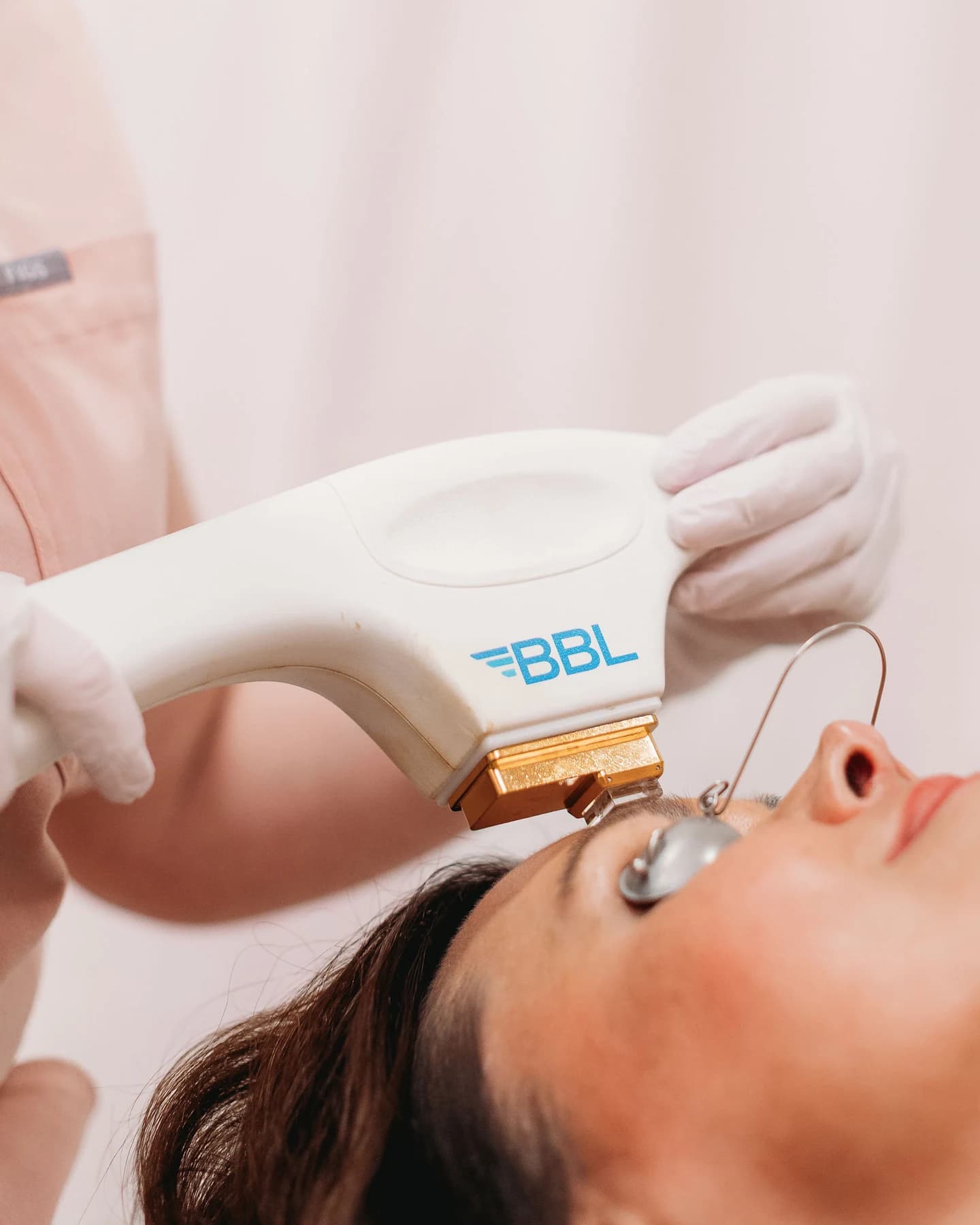 BBL Clear + Young treatment at The Look Aesthetics