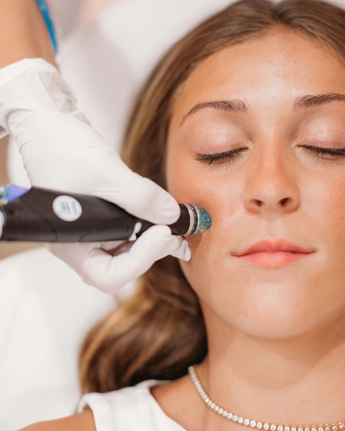 HydraFacial treatment at The Look Aesthetics