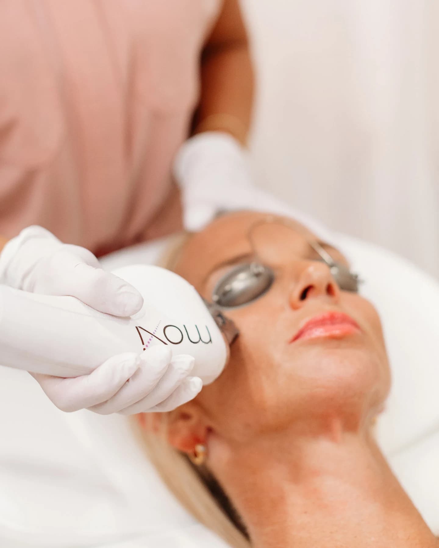 MOXI treatment at The Look Aesthetics