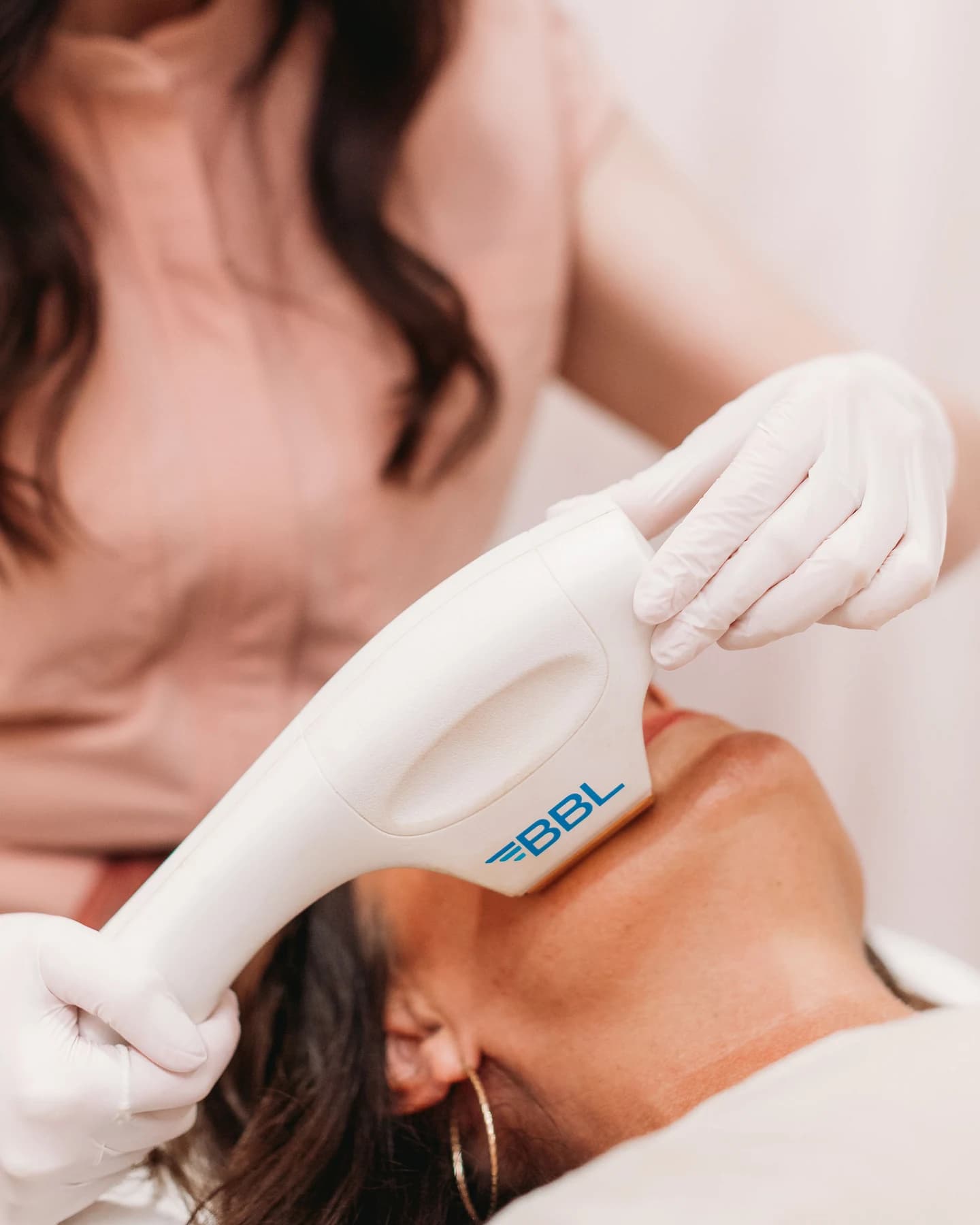 SkinTyte treatment at The Look Aesthetics