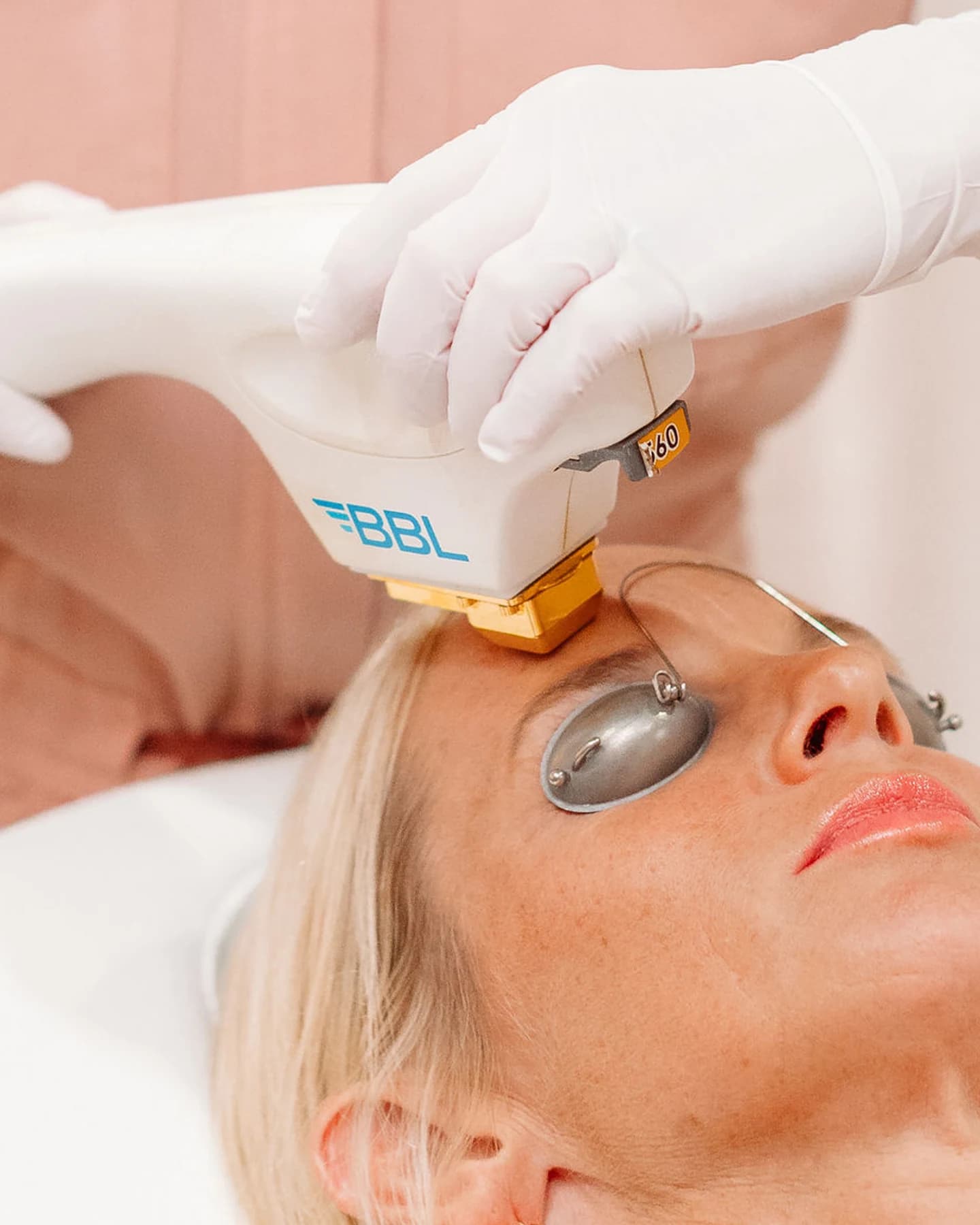SkinTyte treatment at The Look Aesthetics