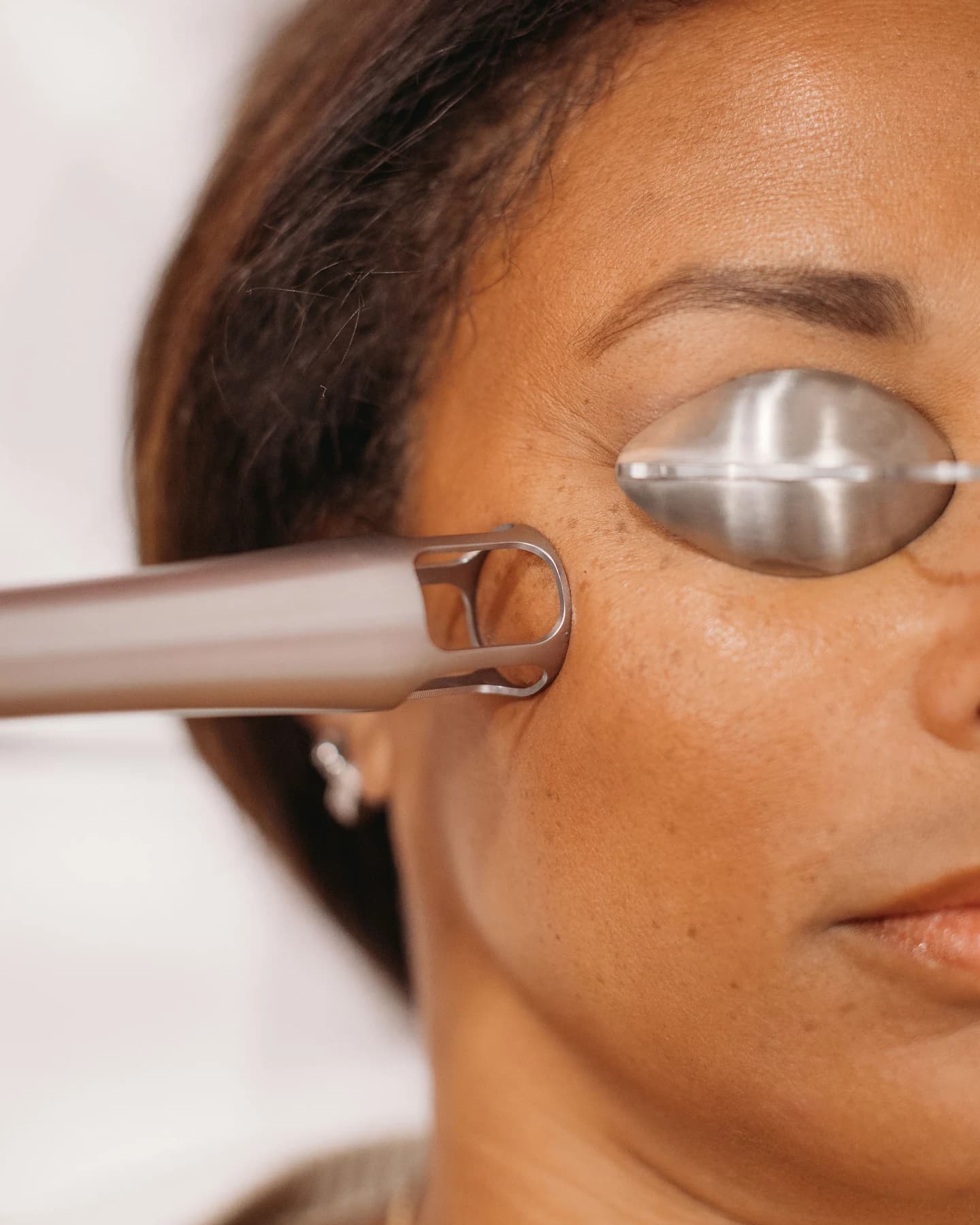 UltraClear treatment at The Look Aesthetics
