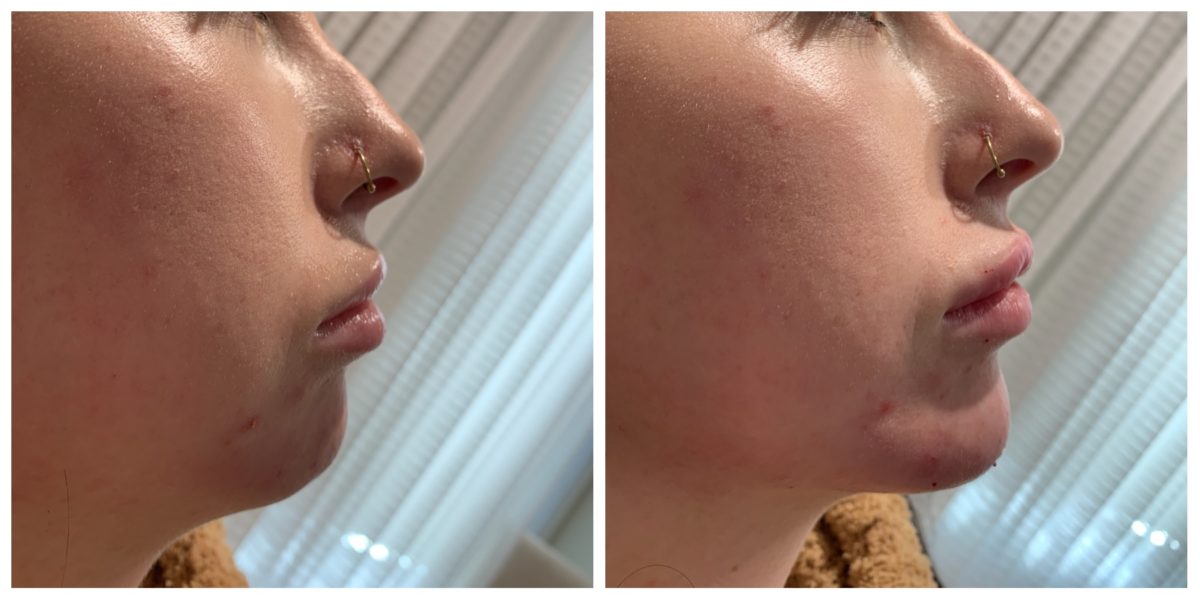 How To Make Your Side Profile Look Better Melbourne Ardiattle